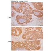 Solarbio K111736P Anti-DAAM2 Polyclonal Antibody