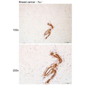 Solarbio K112137P Anti-OGA Polyclonal Antibody
