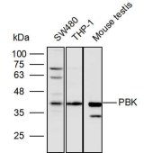 Solarbio K111766P Anti-PBK Polyclonal Antibody