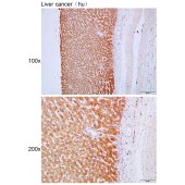 Solarbio K111667P Anti-UGT1A9 Polyclonal Antibody