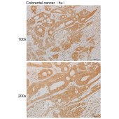 Solarbio K111892P Anti-LIPE Polyclonal Antibody