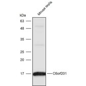 Solarbio K111411P Anti-C6orf201 Polyclonal Antibody