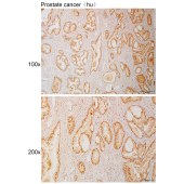 Solarbio K111026P Anti-NUDT16 Polyclonal Antibody