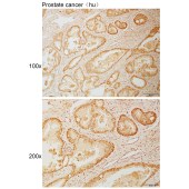 Solarbio K111064P Anti-RAD21 Polyclonal Antibody
