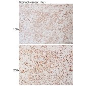 Solarbio K111084P Anti-HNRNPUL2 Polyclonal Antibody