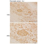 Solarbio K111413P Anti-INTS6 Polyclonal Antibody