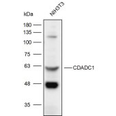 Solarbio K111963P Anti-CDADC1 Polyclonal Antibody
