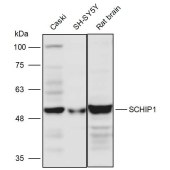 Solarbio K111446P Anti-SCHIP1 Polyclonal Antibody