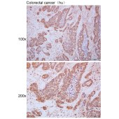Solarbio K111479P Anti-FUT4 Polyclonal Antibody