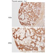 Solarbio K111286P Anti-TNFAIP3 Polyclonal Antibody