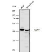 Solarbio K110546P Anti-IGSF11 Polyclonal Antibody