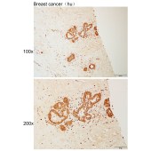 Solarbio K110951P Anti-TNIP1 Polyclonal Antibody