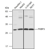 Solarbio K110989P Anti-FKBP3 Polyclonal Antibody