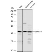 Solarbio K111859P Anti-GPR146 Polyclonal Antibody