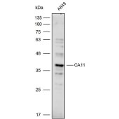 Solarbio K111755P Anti-CA11 Polyclonal Antibody