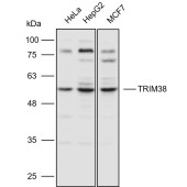 Solarbio K110611P Anti-TRIM38 Polyclonal Antibody