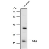 Solarbio K111467P Anti-KLK4 Polyclonal Antibody