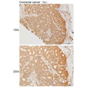 Solarbio K111635P Anti-MOV10L1 Polyclonal Antibody