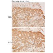 Solarbio K111877P Anti-IRAK3 Polyclonal Antibody