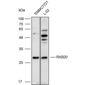 Solarbio K111709P Anti-RAB20 Polyclonal Antibody