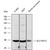 Solarbio K111869P Anti-SLC16A12 Polyclonal Antibody
