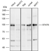 Solarbio K111925P Anti-STAT6 Polyclonal Antibody