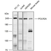 Solarbio K111777P Anti-POLR2A Polyclonal Antibody