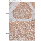 Solarbio K111489P Anti-ARPP21 Polyclonal Antibody