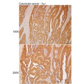 Solarbio K111966P Anti-ARMCX1 Polyclonal Antibody