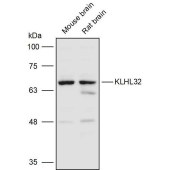 Solarbio K111461P Anti-KLHL32 Polyclonal Antibody