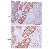 Solarbio K111651P Anti-MYO5C Polyclonal Antibody