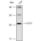 Solarbio K111695P Anti-SNX29P2 Polyclonal Antibody