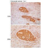 Solarbio K111689P Anti-UCN3 Polyclonal Antibody