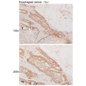 Solarbio K111614P Anti-ERC1 Polyclonal Antibody