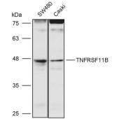 Solarbio K111421P Anti-TNFRSF11B Polyclonal Antibody