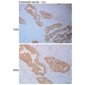 Solarbio K110829P Anti-ADD3 Polyclonal Antibody