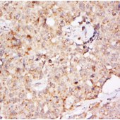 Solarbio K009948P Anti-EphB2 Polyclonal Antibody