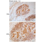 Solarbio K111746P Anti-PPP1R21 Polyclonal Antibody