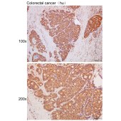 Solarbio K111707P Anti-FBXO6 Polyclonal Antibody