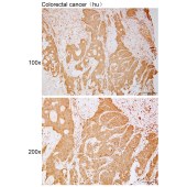 Solarbio K112116P Anti-HSD17B13 Polyclonal Antibody