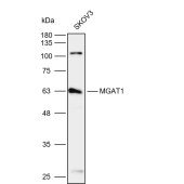 Solarbio K112132P Anti-MGAT1 Polyclonal Antibody