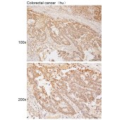 Solarbio K111885P Anti-USP15 Polyclonal Antibody