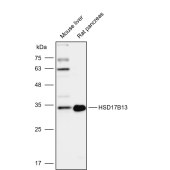 Solarbio K112116P Anti-HSD17B13 Polyclonal Antibody