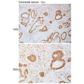 Solarbio K111081P Anti-DYR1A Polyclonal Antibody