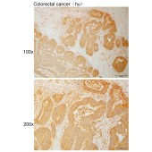 Solarbio K111071P Anti-ABCB10 Polyclonal Antibody