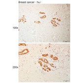 Solarbio K110946P Anti-PUM3 Polyclonal Antibody