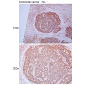 Solarbio K111681P Anti-GPN3 Polyclonal Antibody