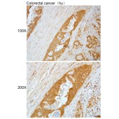 Solarbio K112112P Anti-SPRY1 Polyclonal Antibody