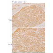 Solarbio K110553P Anti-DTNBP1 Polyclonal Antibody