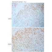 Solarbio K110823P Anti-HNRNPM Polyclonal Antibody